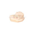 Customized Layered Zirconia Crowns